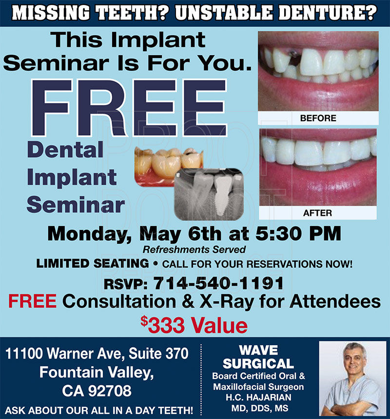 Free Dental Implants Seminar